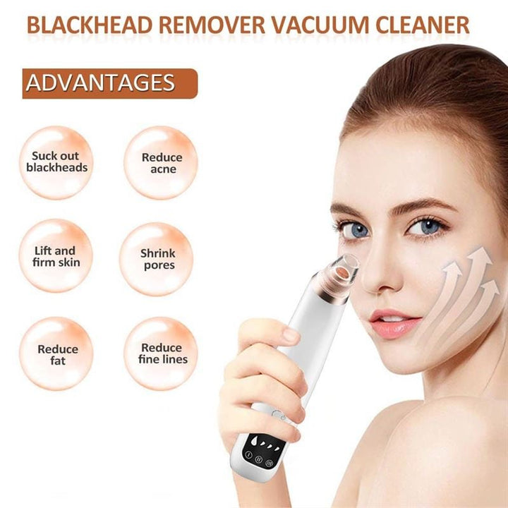 5 - in - 1 Blackhead remover / blackhead sucker - | Fashiongirl