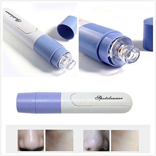 Blackhead Vacuum Cleanser Blackhead suction / blackhead remover - | Fashiongirl