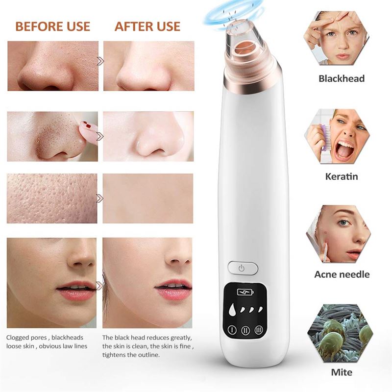 Mr Blackhead remover Suction - Blackhead suction / blackhead remover - Blackhead