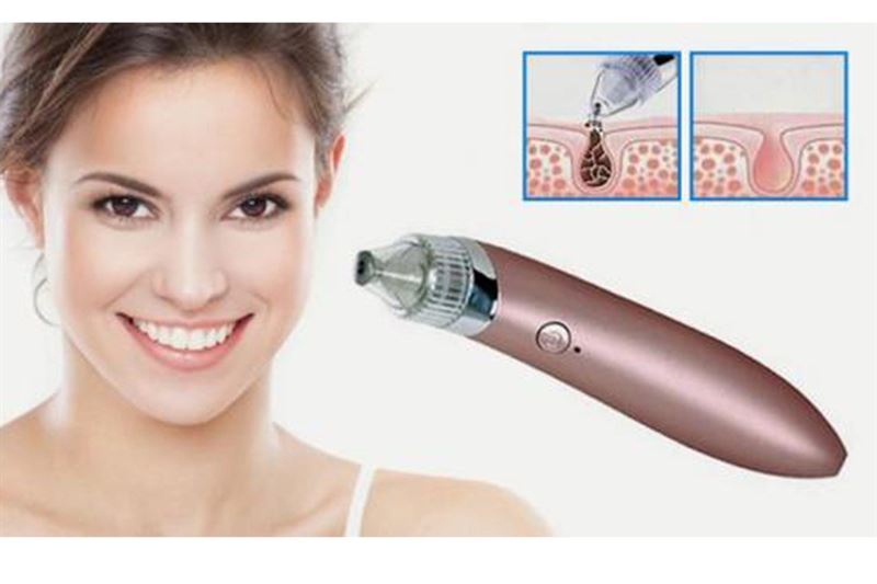 UNIQ Blackhead Suction - Blackhead suction - | Fashiongirl